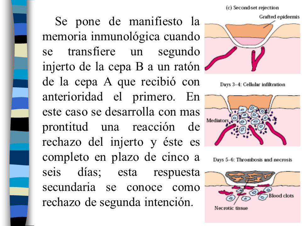 Se pone de manifiesto la memoria inmunológica cuando se transfiere un segundo injerto de la cepa B a un ratón de la cepa A que recibió con anterioridad el primero.