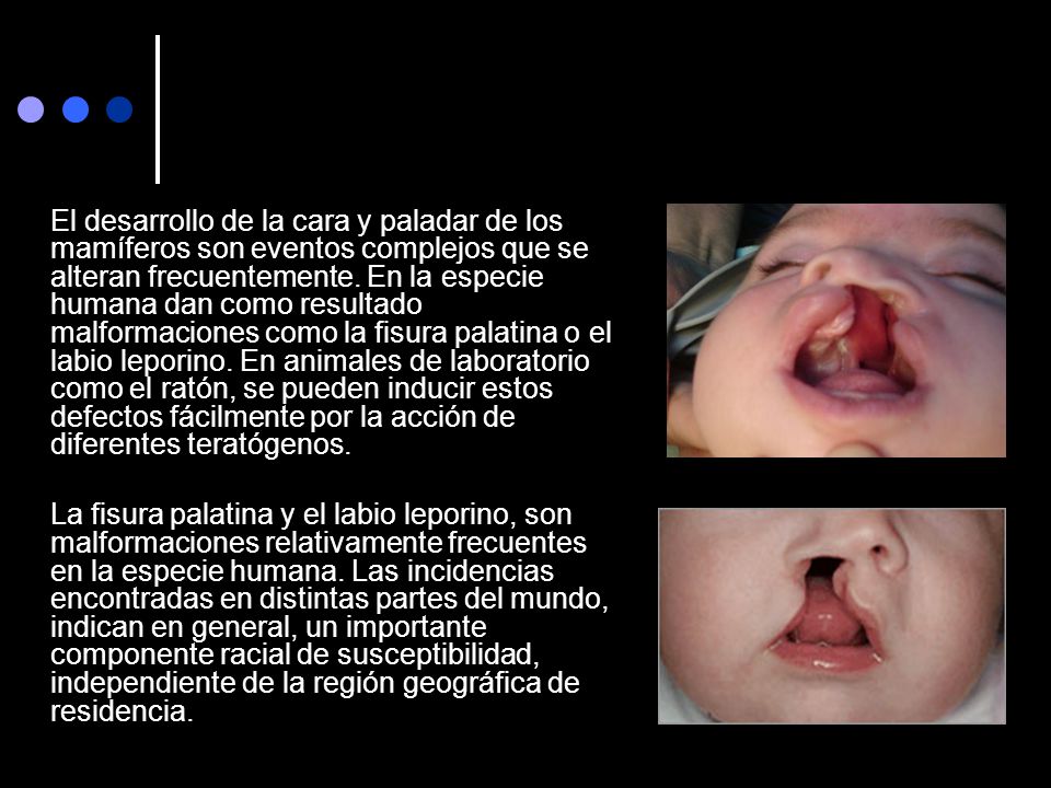 El desarrollo de la cara y paladar de los mamíferos son eventos complejos que se alteran frecuentemente. En la especie humana dan como resultado malformaciones como la fisura palatina o el labio leporino. En animales de laboratorio como el ratón, se pueden inducir estos defectos fácilmente por la acción de diferentes teratógenos.