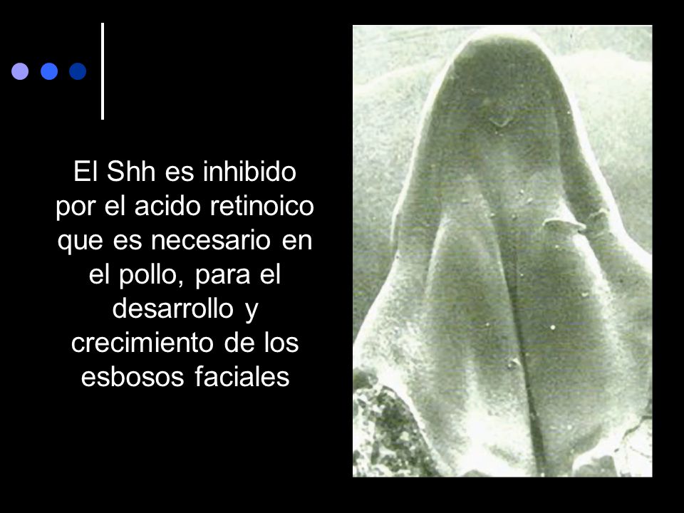 El Shh es inhibido por el acido retinoico que es necesario en el pollo, para el desarrollo y crecimiento de los esbosos faciales