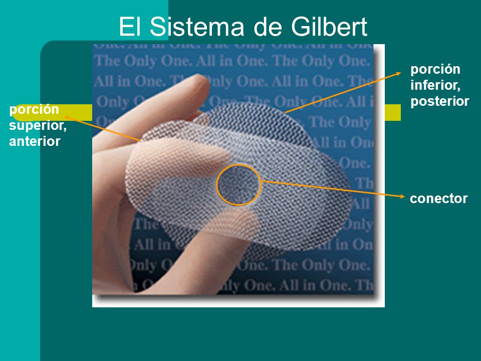 El Sistema de Gilbert porción inferior, posterior