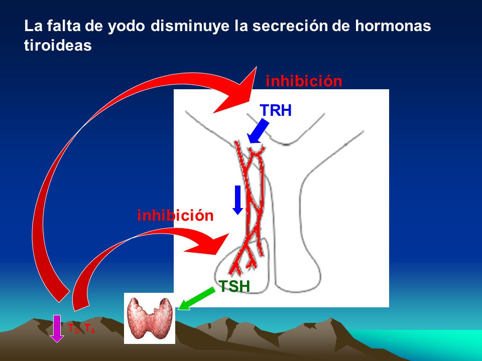 La falta de yodo disminuye la secreción de hormonas tiroideas
