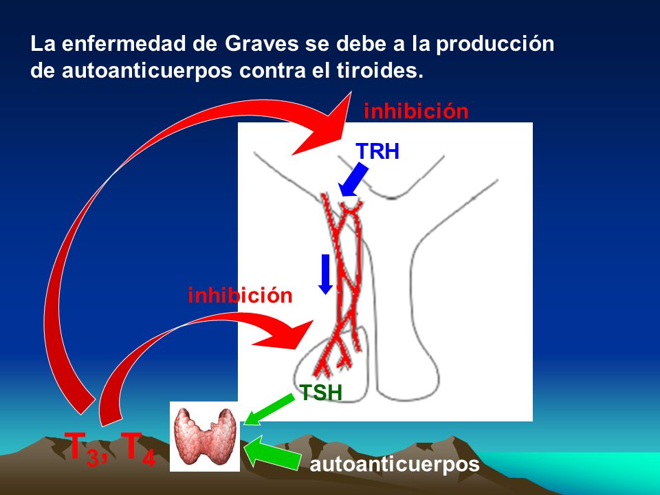 La enfermedad de Graves se debe a la producción de autoanticuerpos contra el tiroides.