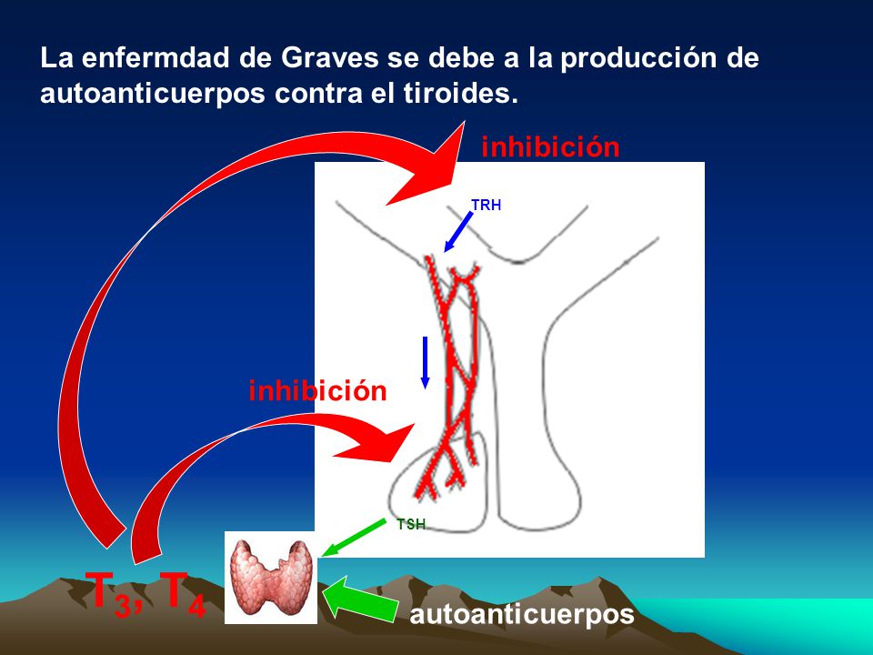 La enfermdad de Graves se debe a la producción de autoanticuerpos contra el tiroides.