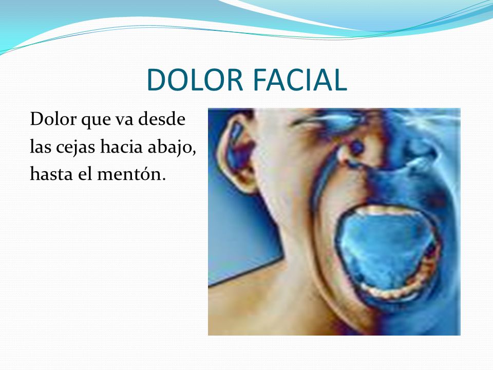 DOLOR FACIAL Dolor que va desde las cejas hacia abajo,