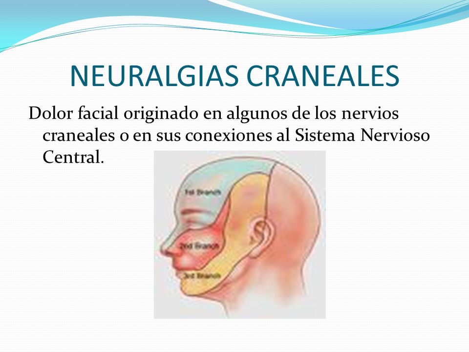 NEURALGIAS CRANEALES Dolor facial originado en algunos de los nervios craneales o en sus conexiones al Sistema Nervioso Central.