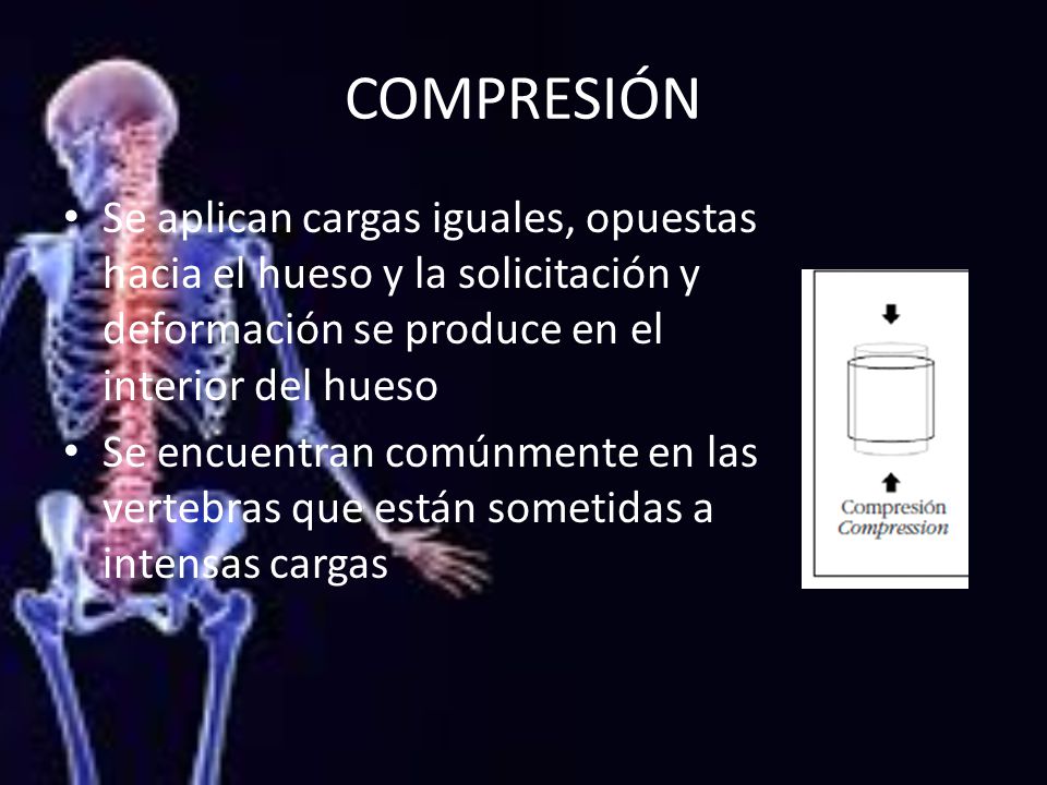 COMPRESIÓN Se aplican cargas iguales, opuestas hacia el hueso y la solicitación y deformación se produce en el interior del hueso.