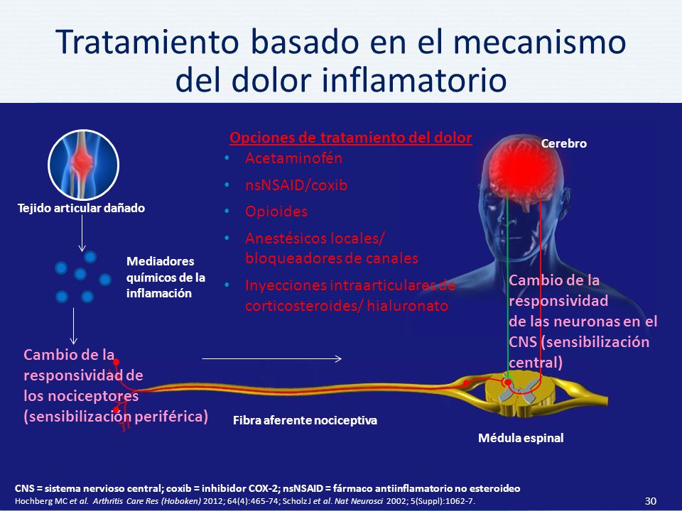 Tratamiento basado en el mecanismo del dolor inflamatorio