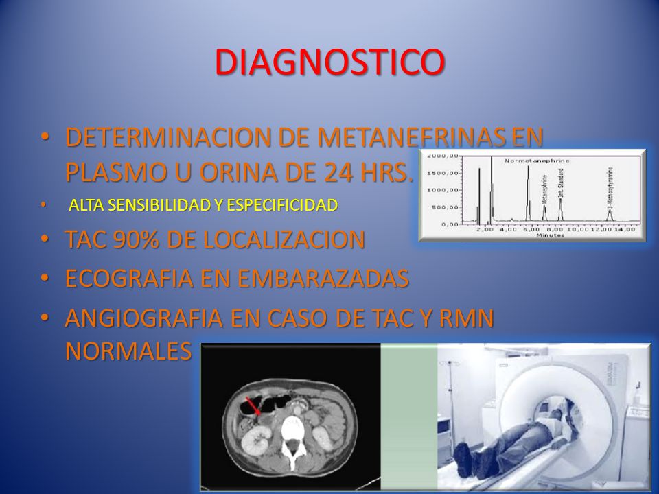 DIAGNOSTICO DETERMINACION DE METANEFRINAS EN PLASMO U ORINA DE 24 HRS.