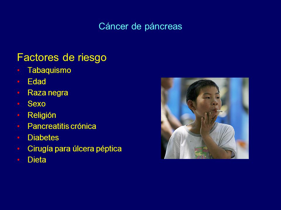 Factores de riesgo Cáncer de páncreas Tabaquismo Edad Raza negra Sexo