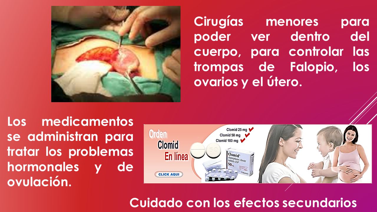 Cirugías menores para poder ver dentro del cuerpo, para controlar las trompas de Falopio, los ovarios y el útero.