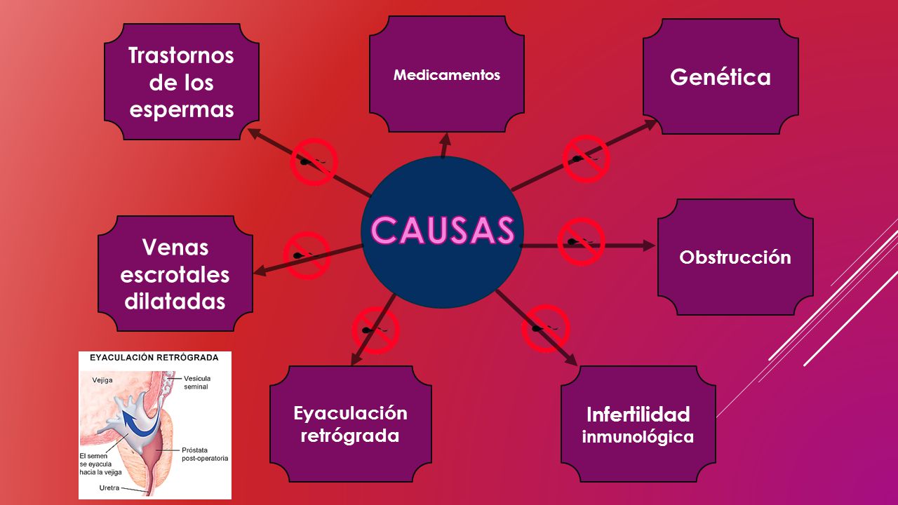 CAUSAS Trastornos de los espermas Genética Venas escrotales dilatadas