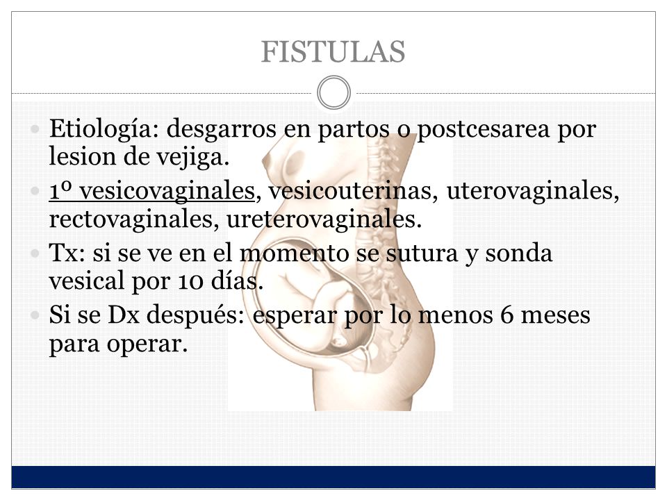 FISTULAS Etiología: desgarros en partos o postcesarea por lesion de vejiga.