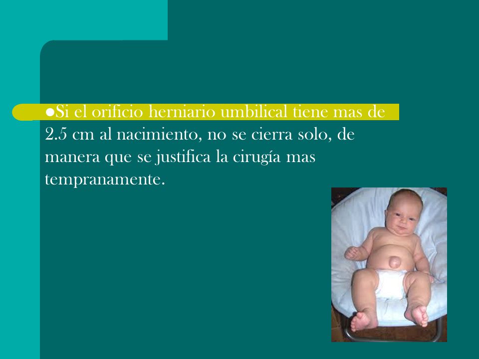 Si el orificio herniario umbilical tiene mas de 2