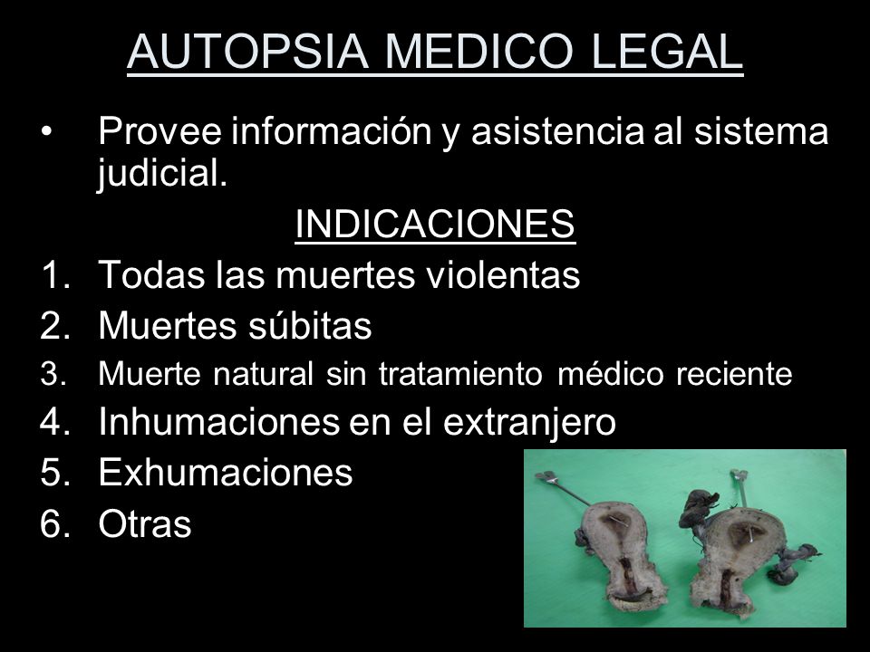 AUTOPSIA MEDICO LEGAL Provee información y asistencia al sistema judicial. INDICACIONES. Todas las muertes violentas.