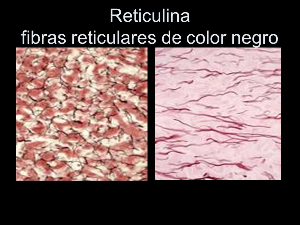 Reticulina fibras reticulares de color negro