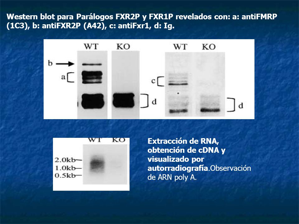 Western blot para Parálogos FXR2P y FXR1P revelados con: a: antiFMRP (1C3), b: antiFXR2P (A42), c: antiFxr1, d: Ig.