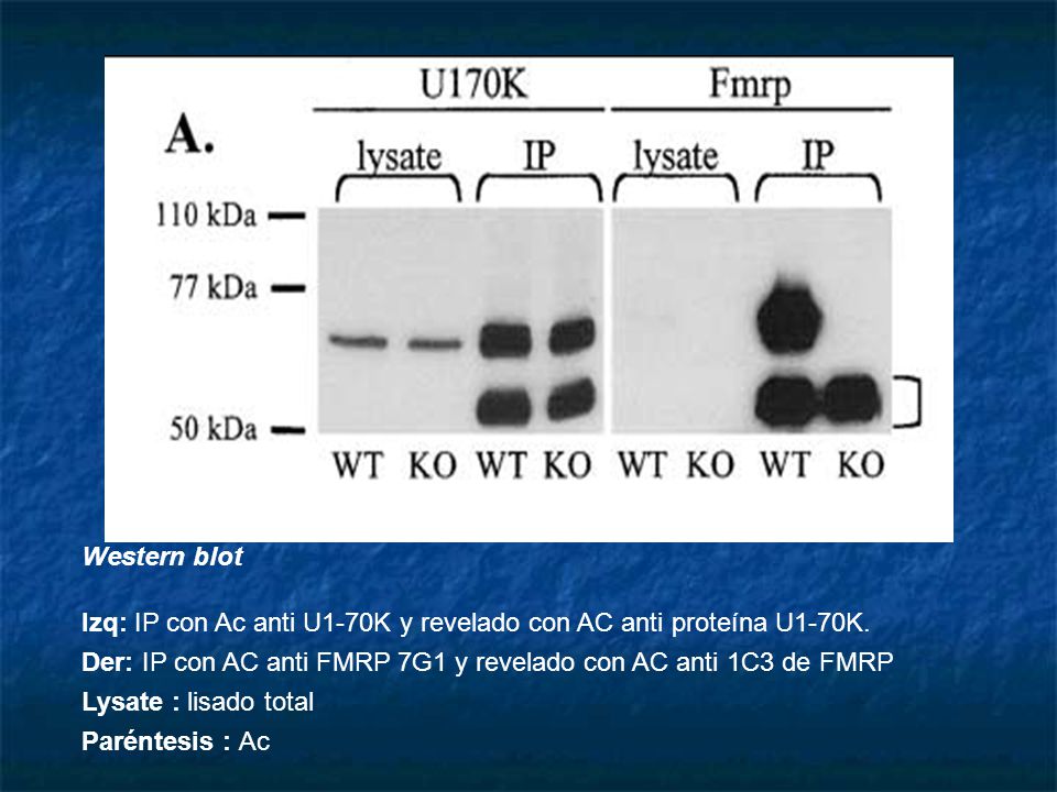 Western blot Izq: IP con Ac anti U1-70K y revelado con AC anti proteína U1-70K. Der: IP con AC anti FMRP 7G1 y revelado con AC anti 1C3 de FMRP.