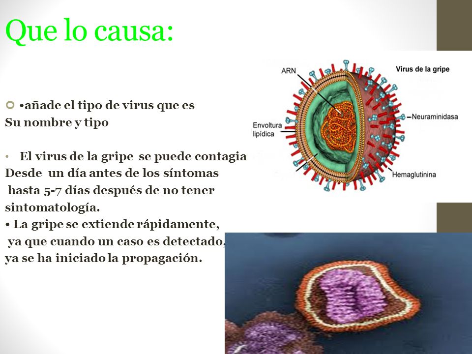 Que lo causa: •añade el tipo de virus que es Su nombre y tipo