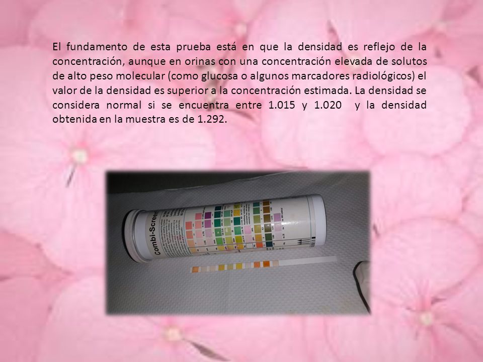 El fundamento de esta prueba está en que la densidad es reflejo de la concentración, aunque en orinas con una concentración elevada de solutos de alto peso molecular (como glucosa o algunos marcadores radiológicos) el valor de la densidad es superior a la concentración estimada.
