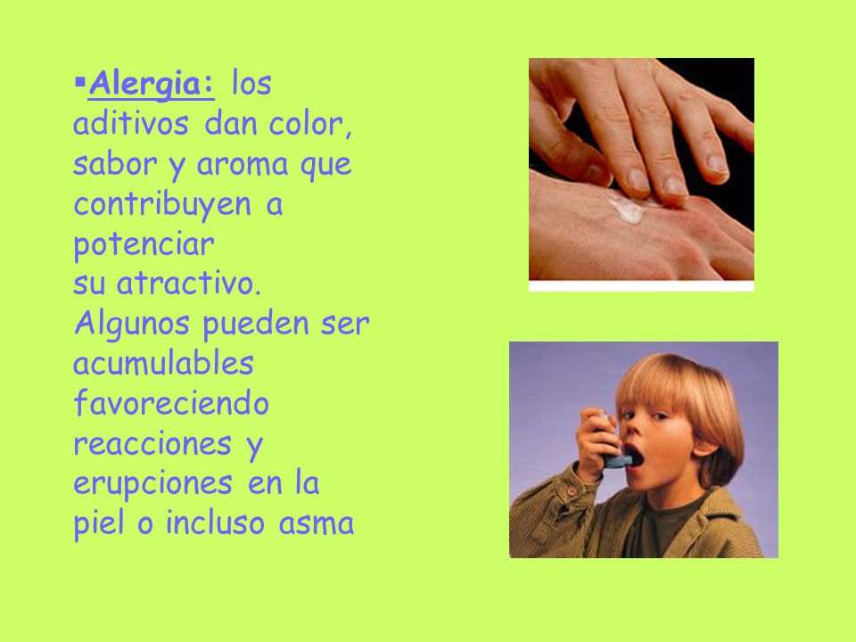 Alergia: los aditivos dan color, sabor y aroma que contribuyen a potenciar