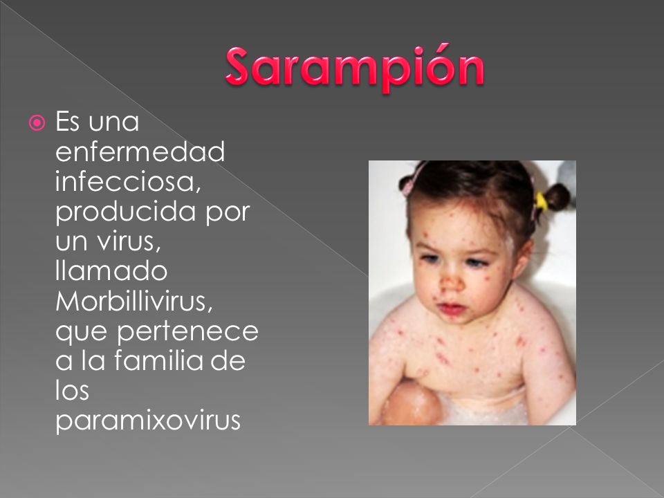 Sarampión Es una enfermedad infecciosa, producida por un virus, llamado Morbillivirus, que pertenece a la familia de los paramixovirus.