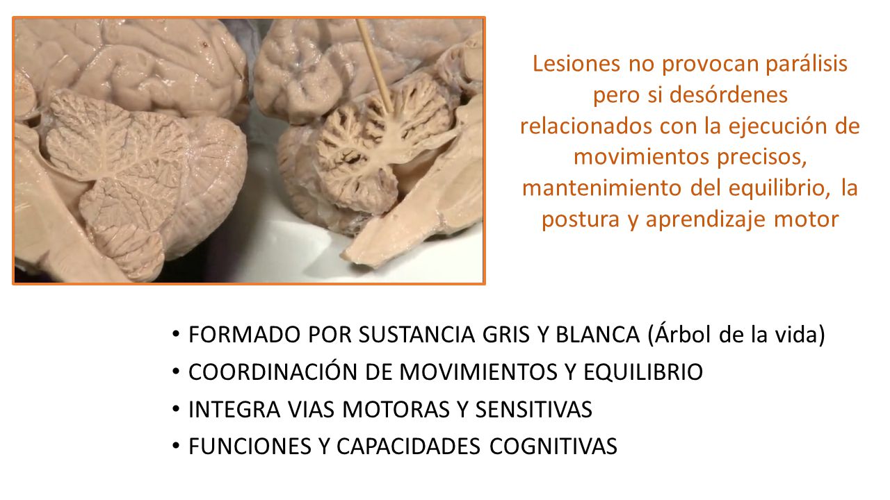 Lesiones no provocan parálisis pero si desórdenes relacionados con la ejecución de movimientos precisos, mantenimiento del equilibrio, la postura y aprendizaje motor