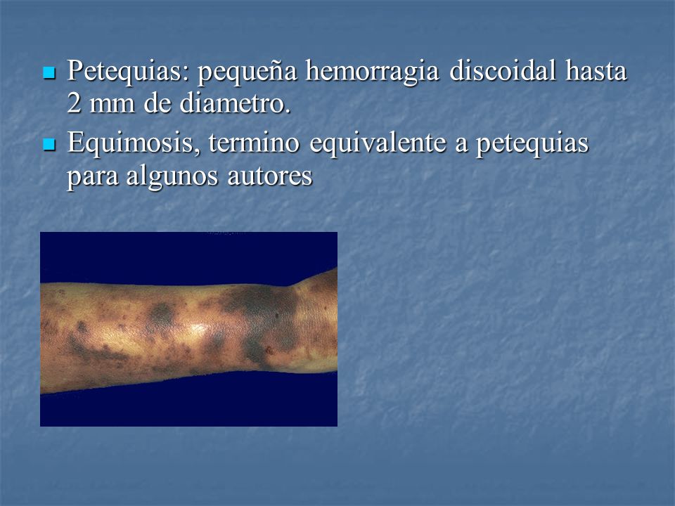 Petequias: pequeña hemorragia discoidal hasta 2 mm de diametro.
