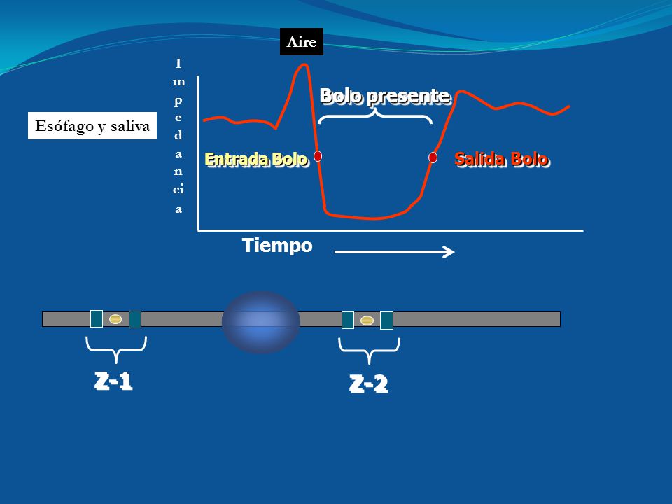 Z-1 Z-2 Bolo presente Tiempo Aire Esófago y saliva Salida Bolo