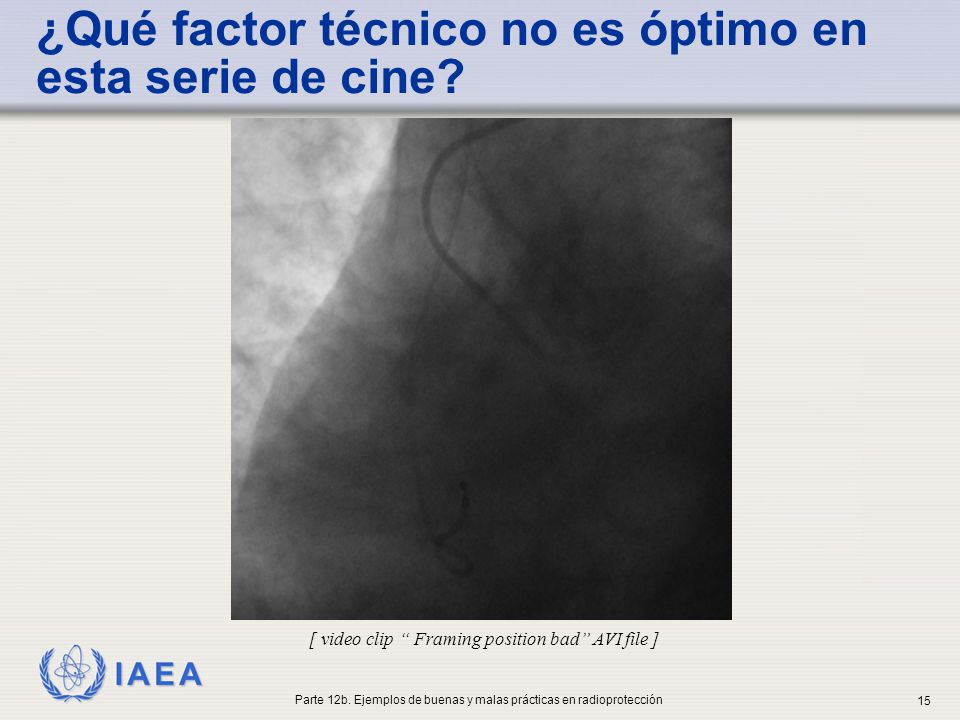 ¿Qué factor técnico no es óptimo en esta serie de cine
