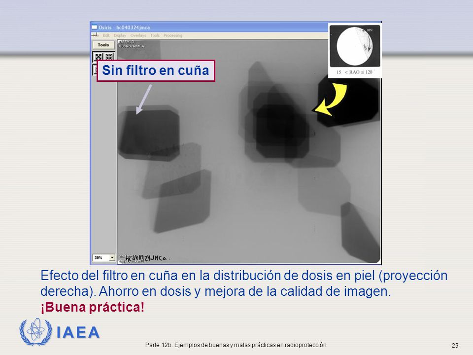 Parte 12b. Ejemplos de buenas y malas prácticas en radioprotección