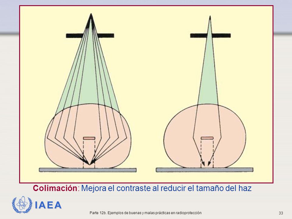 Parte 12b. Ejemplos de buenas y malas prácticas en radioprotección