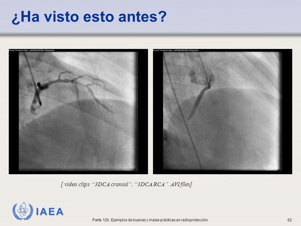 Parte 12b. Ejemplos de buenas y malas prácticas en radioprotección
