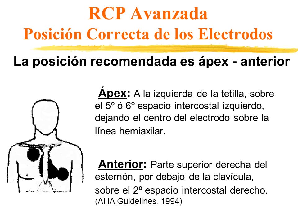 RCP Avanzada Posición Correcta de los Electrodos