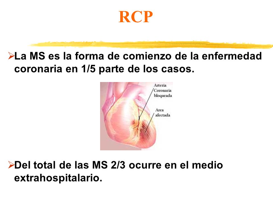 RCP La MS es la forma de comienzo de la enfermedad coronaria en 1/5 parte de los casos.