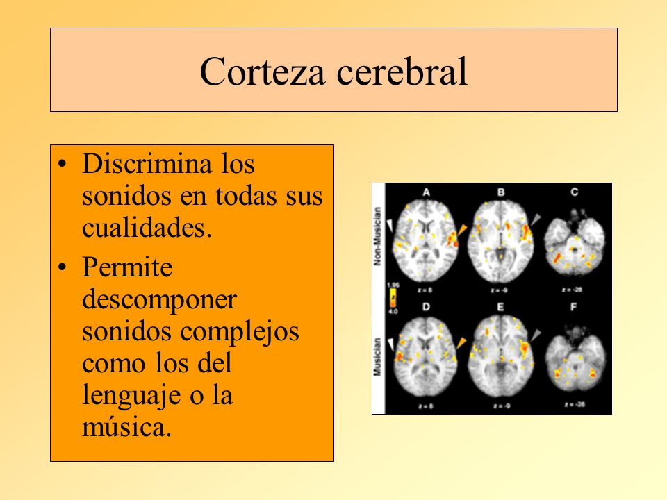 Corteza cerebral Discrimina los sonidos en todas sus cualidades.
