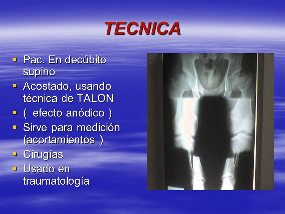 TECNICA Pac. En decúbito supino Acostado, usando técnica de TALON