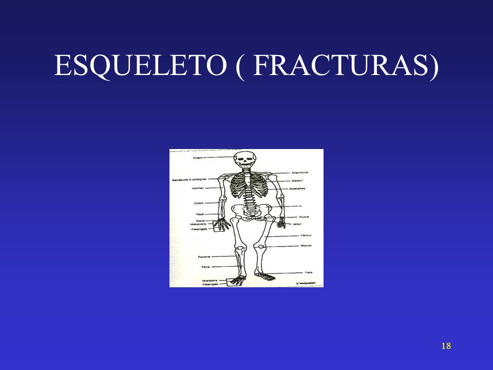 ESQUELETO ( FRACTURAS)