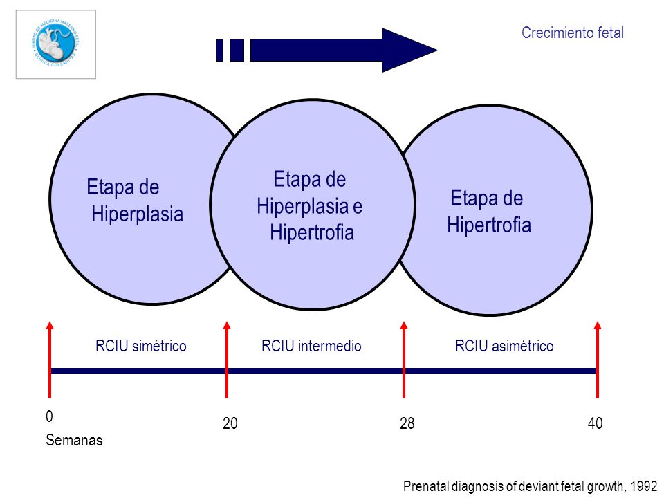 Etapa de Etapa de Hiperplasia Hiperplasia e Etapa de Hipertrofia