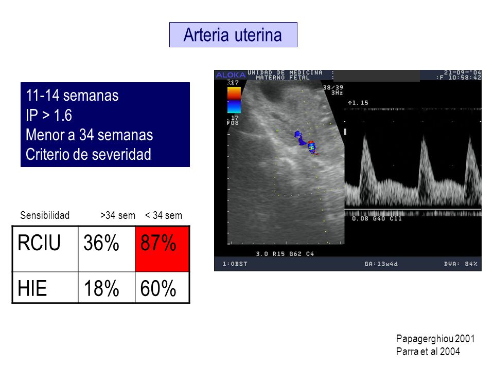 RCIU 36% 87% HIE 18% 60% Arteria uterina semanas IP > 1.6
