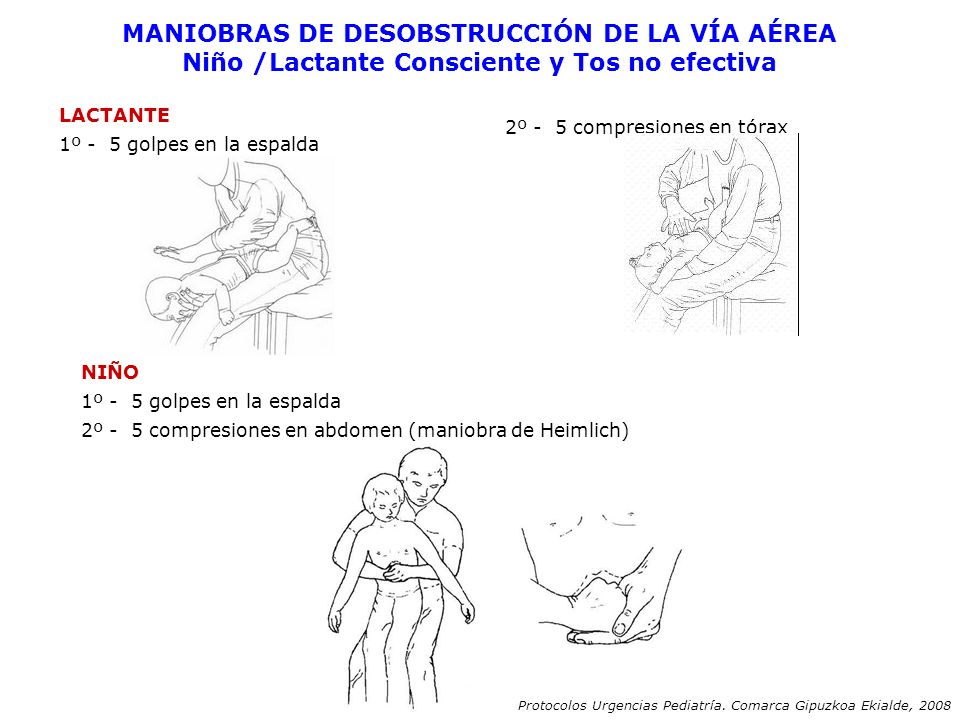 MANIOBRAS DE DESOBSTRUCCIÓN DE LA VÍA AÉREA Niño /Lactante Consciente y Tos no efectiva