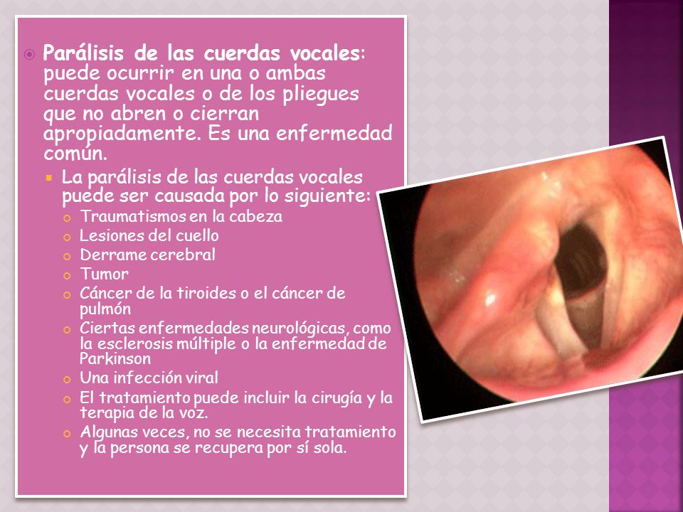 Parálisis de las cuerdas vocales: puede ocurrir en una o ambas cuerdas vocales o de los pliegues que no abren o cierran apropiadamente. Es una enfermedad común.