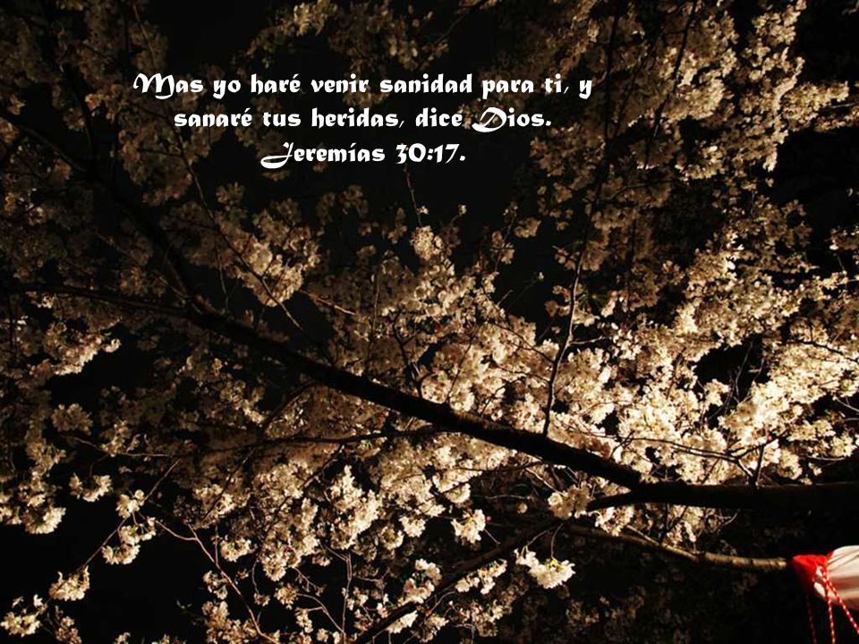 Mas yo haré venir sanidad para ti, y sanaré tus heridas, dice Dios.