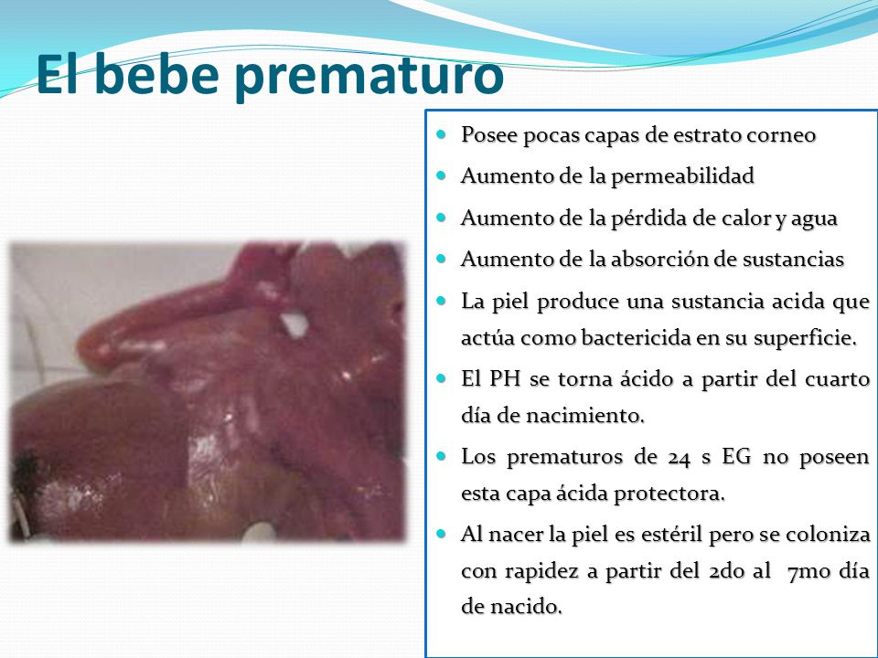 El bebe prematuro Posee pocas capas de estrato corneo