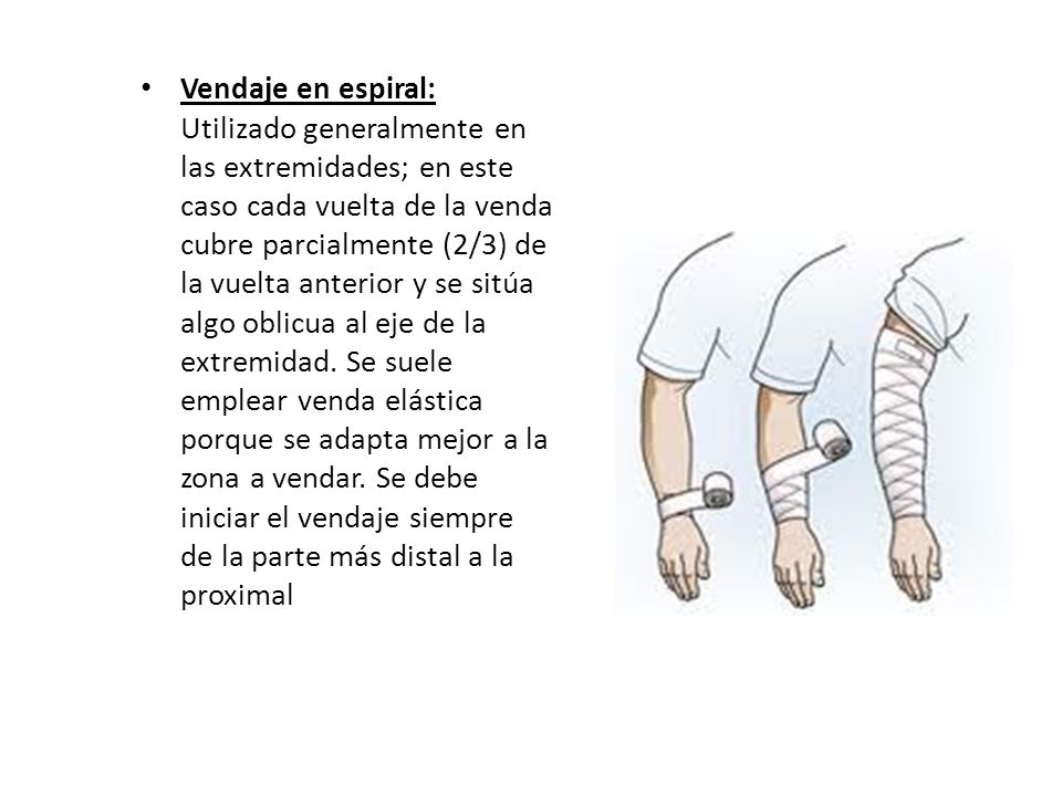 Vendaje en espiral: Utilizado generalmente en las extremidades; en este caso cada vuelta de la venda cubre parcialmente (2/3) de la vuelta anterior y se sitúa algo oblicua al eje de la extremidad.
