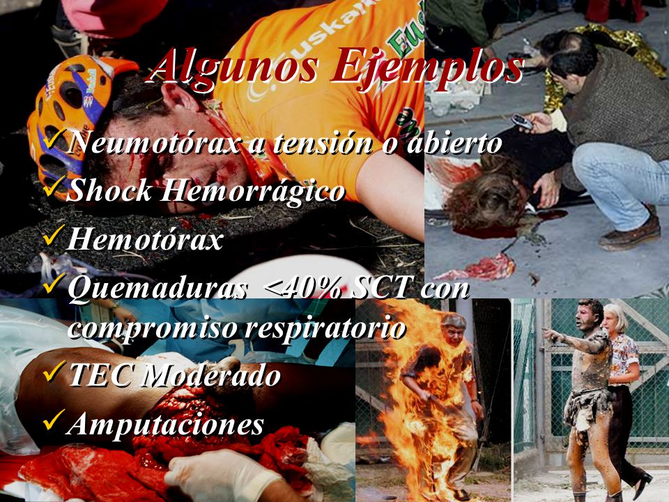 Algunos Ejemplos Neumotórax a tensión o abierto Shock Hemorrágico