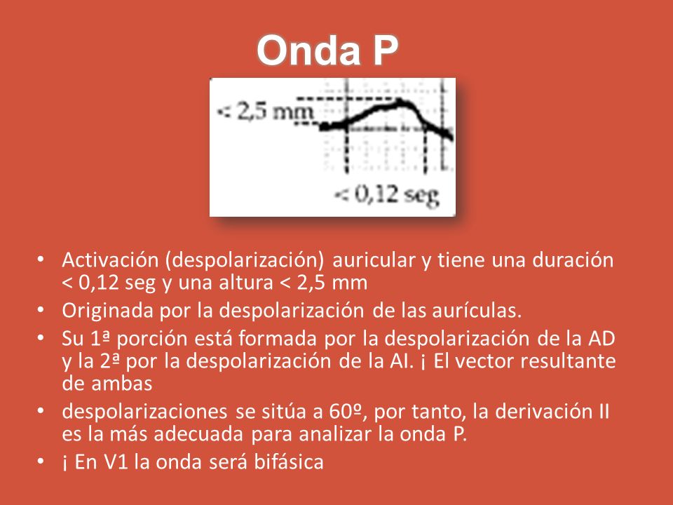 Onda P Activación (despolarización) auricular y tiene una duración < 0,12 seg y una altura < 2,5 mm.