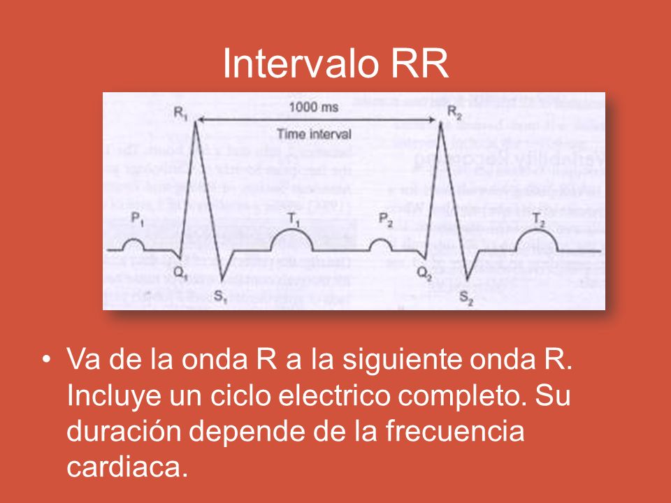 Intervalo RR Va de la onda R a la siguiente onda R.