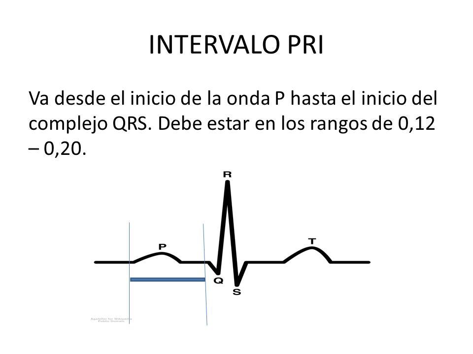 INTERVALO PRI Va desde el inicio de la onda P hasta el inicio del complejo QRS.