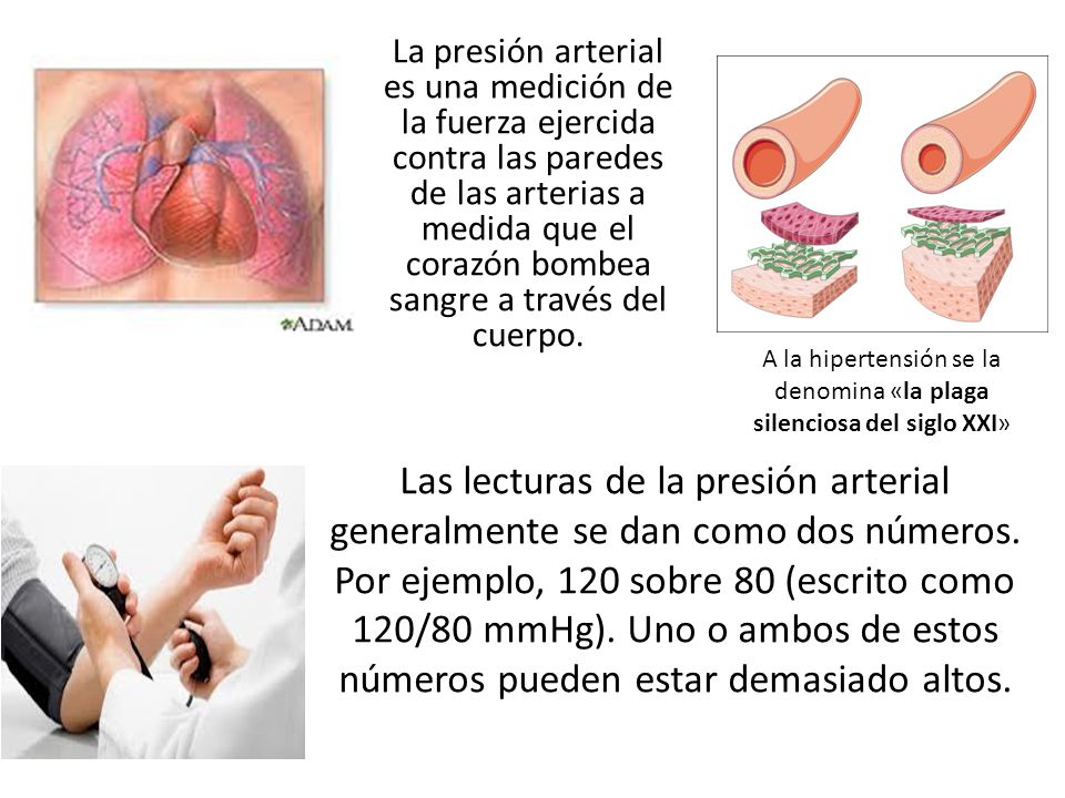 A la hipertensión se la denomina «la plaga silenciosa del siglo XXI»