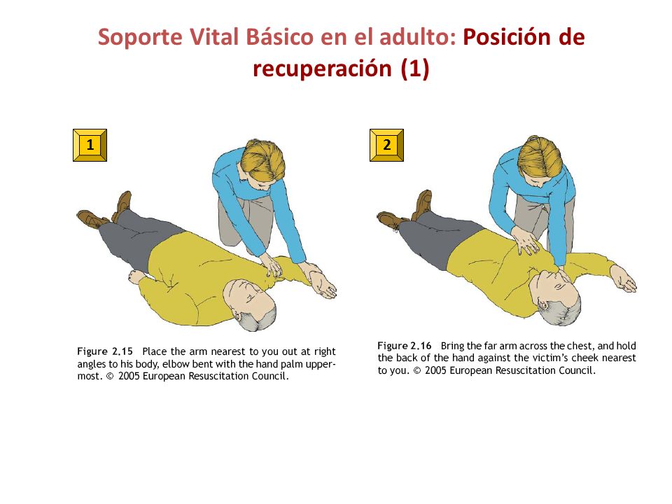 Soporte Vital Básico en el adulto: Posición de recuperación (1)